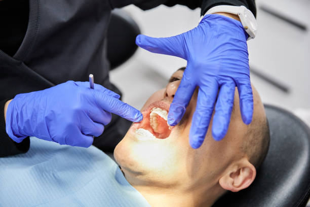 Best Broken or Cracked Tooth Emergency Dentist in High Springs, FL