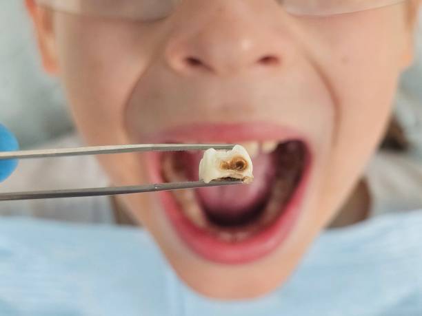 Best Emergency Dental Services for Seniors in High Springs, FL